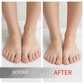 🏠 LIMITED-TIME 40% OFF! ✨Nail Repair Essence for Damaged Nails💅🏻