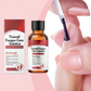 🏠 LIMITED-TIME 40% OFF! ✨Nail Repair Essence for Damaged Nails💅🏻