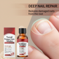 🏠 LIMITED-TIME 40% OFF! ✨Nail Repair Essence for Damaged Nails💅🏻